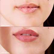 Instant Lip Plumper